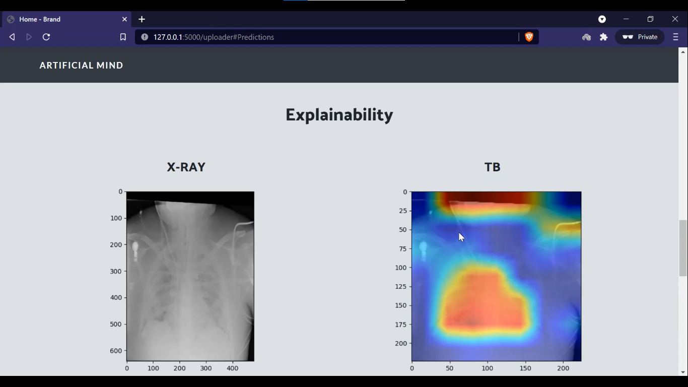 XRayd Explainability with Grad-CAM